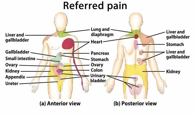 Referred Pain Patterns: Anterior and Posterior Views