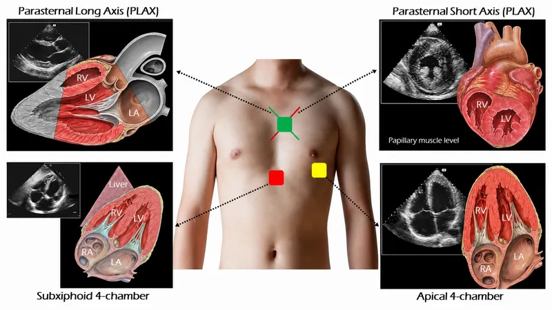 Cardiac Ultrasound Views and Corresponding Anatomy