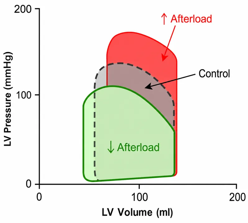 Cardiac PV loop: altered afterload