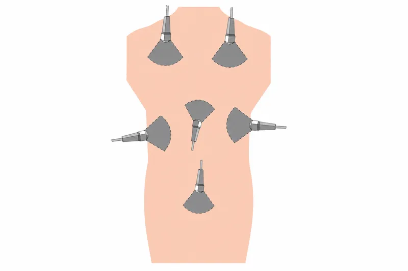 eFAST scan windows on a torso