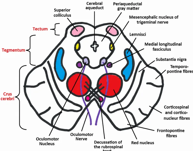Midbrain cross-section with nuclei and tracts