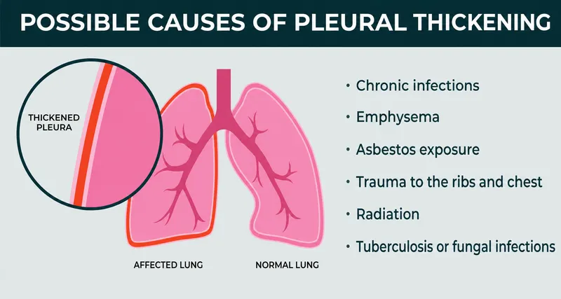 Possible causes of pleural thickening