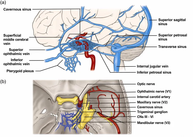 Cavernous sinus anatomy with ICA and cranial nerves