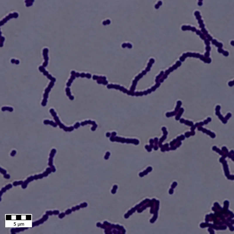 Streptococcus agalactiae (Group B Strep) Gram stain
