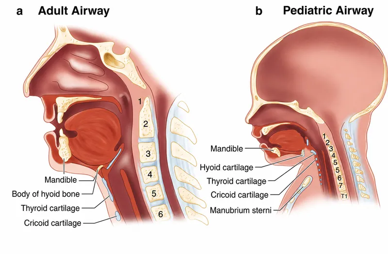 Adult vs Pediatric Airway Anatomy
