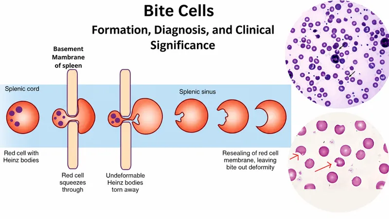 Bite cell formation and peripheral smear