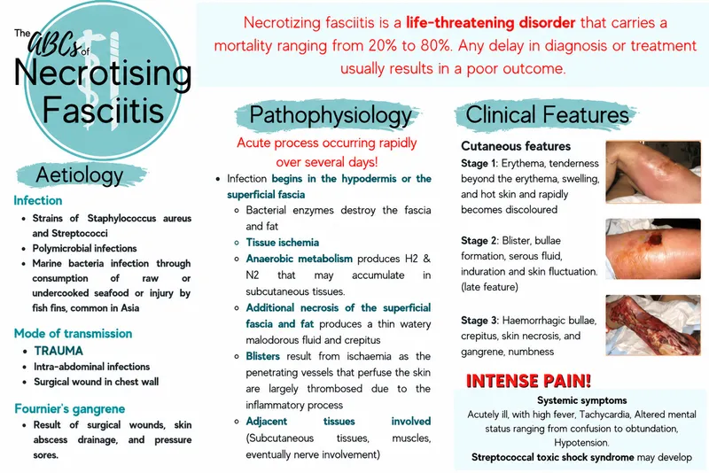 Necrotizing Fasciitis: Aetiology, Pathophysiology, Features