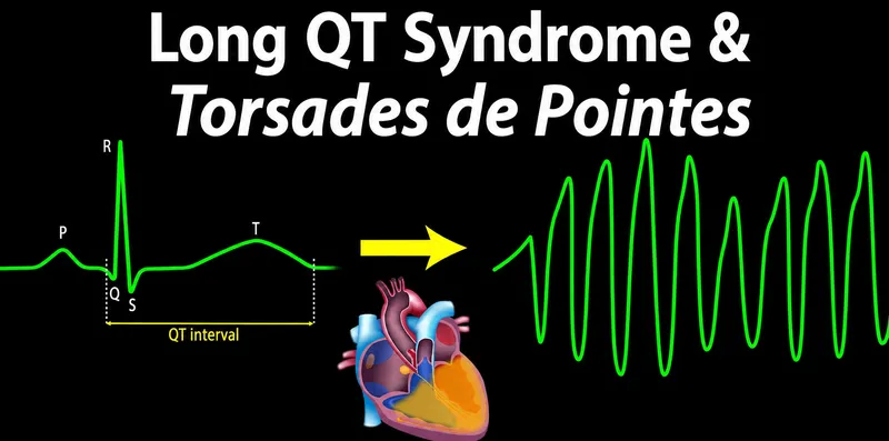 Long QT Syndrome and Torsades de Pointes ECG