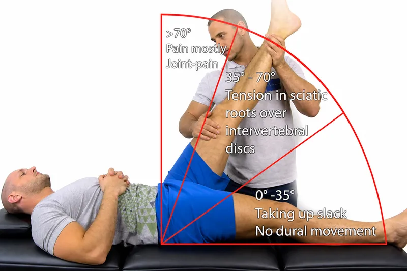 Straight Leg Raise Test for Lumbar Radiculopathy