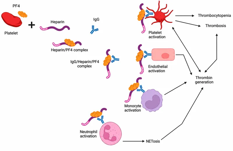 Heparin-Induced Thrombocytopenia Pathophysiology