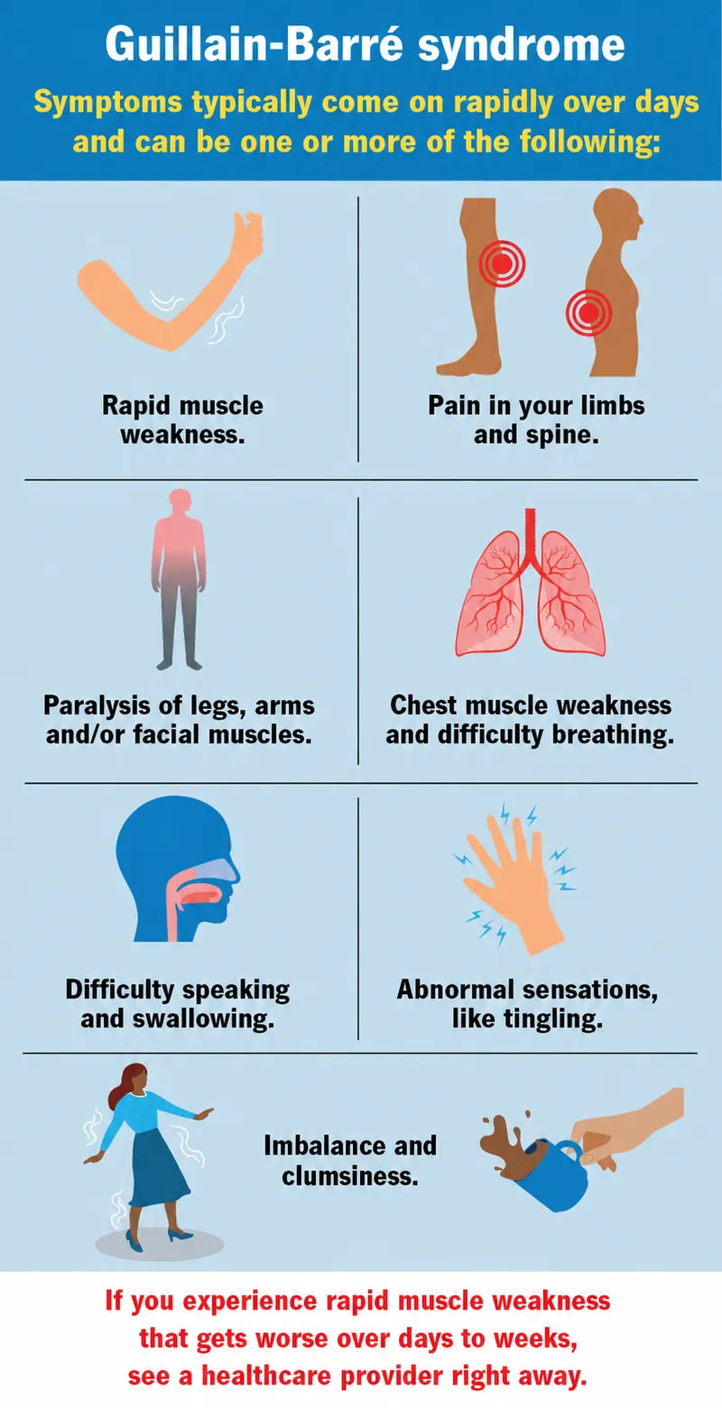 Guillain-Barré Syndrome Symptoms