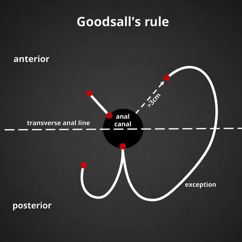 Goodsall's rule diagram with examples