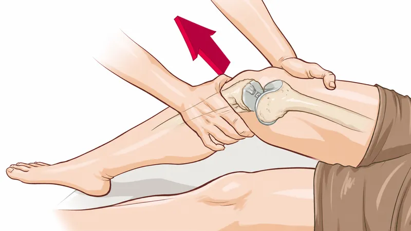 Lachman Test for ACL Injury