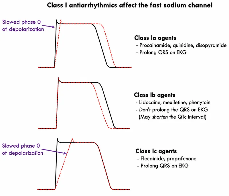 Class I antiarrhythmics effect on cardiac action potential