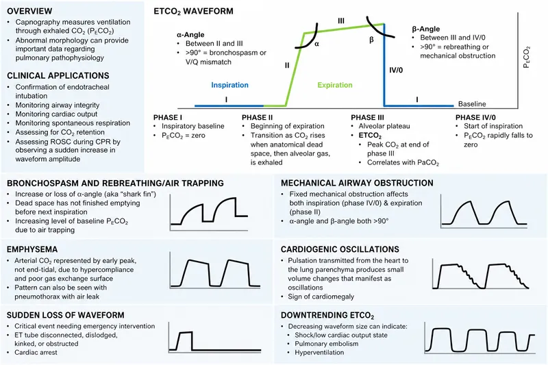 Capnography Waveforms: Normal and Abnormal Patterns
