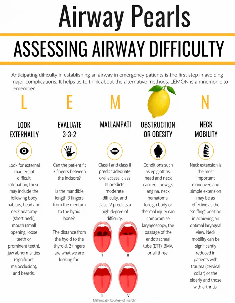 LEMON mnemonic for assessing airway difficulty