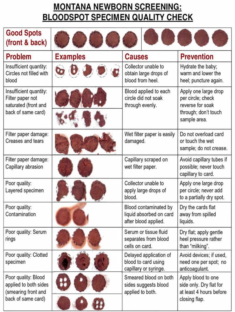 Newborn Blood Spot Specimen Quality Check