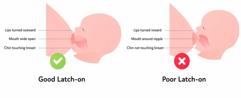 Good vs. Poor Breastfeeding Latch