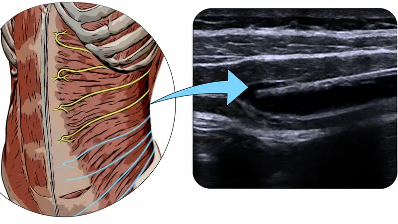 Ultrasound view of TAP block anatomy