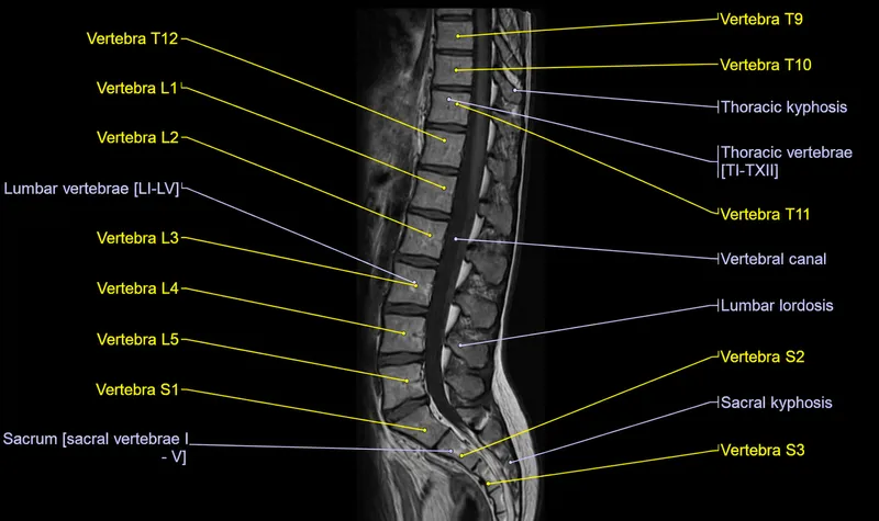 Spine MRI sagittal T2 with vertebral and curvature labels