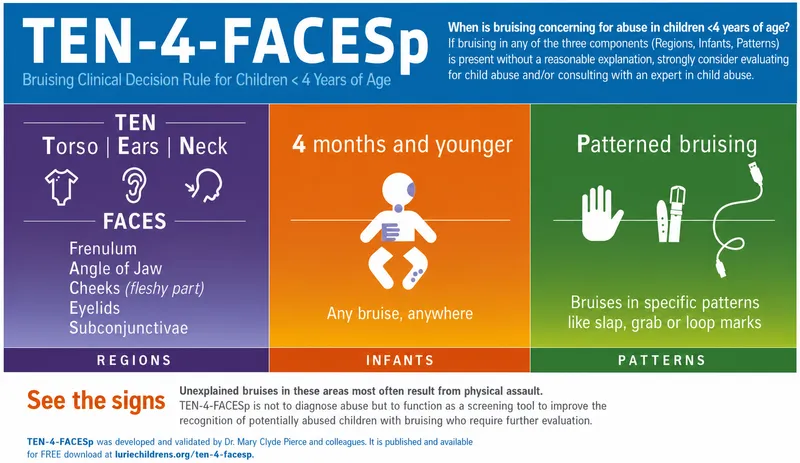 Figure 2: Clinical photograph showing patterned bruising consistent with belt marks on child's back