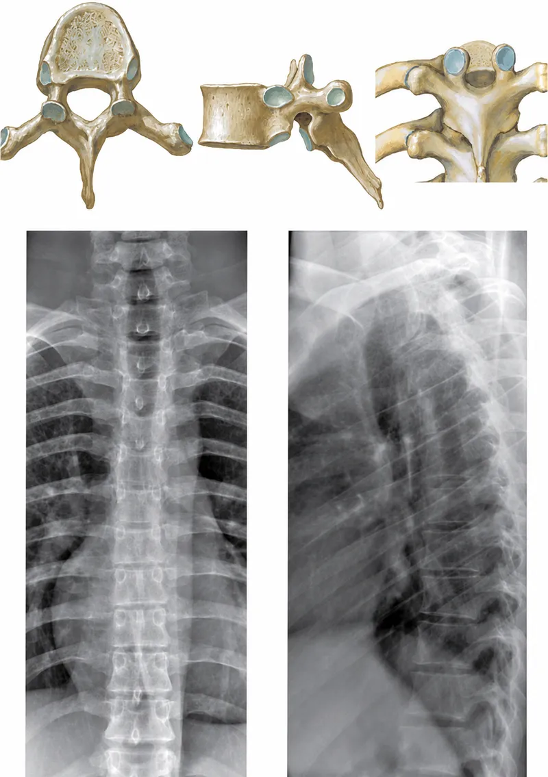 Thoracic spine AP and lateral radiographs with anatomy