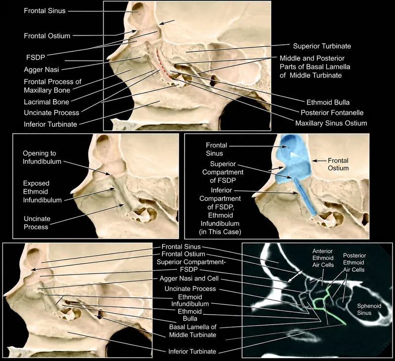 Frontal sinus drainage pathway anatomy