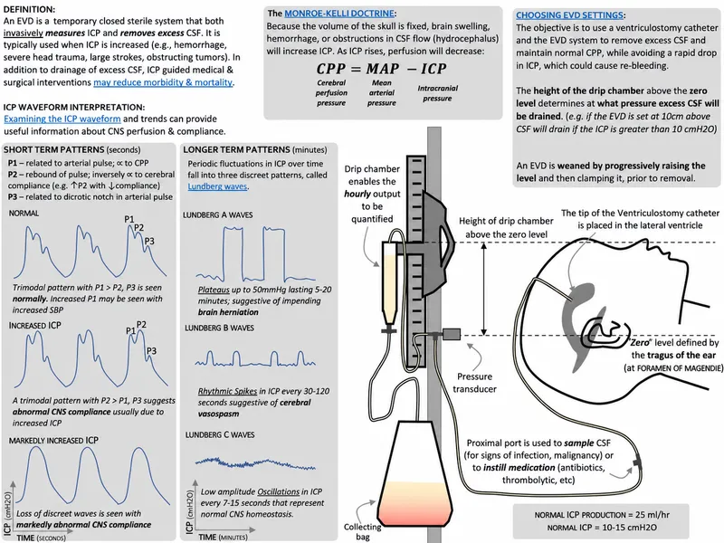 EVD and ICP Waveform Interpretation