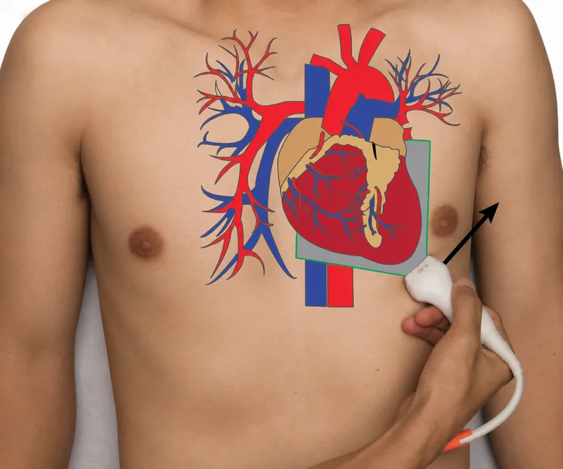 Cardiac POCUS probe placement