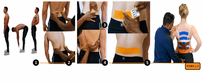 Spinal Rehab: Test, Trigger, Tape, Train Method
