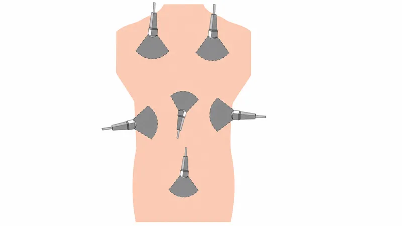 eFAST exam probe placement for trauma assessment