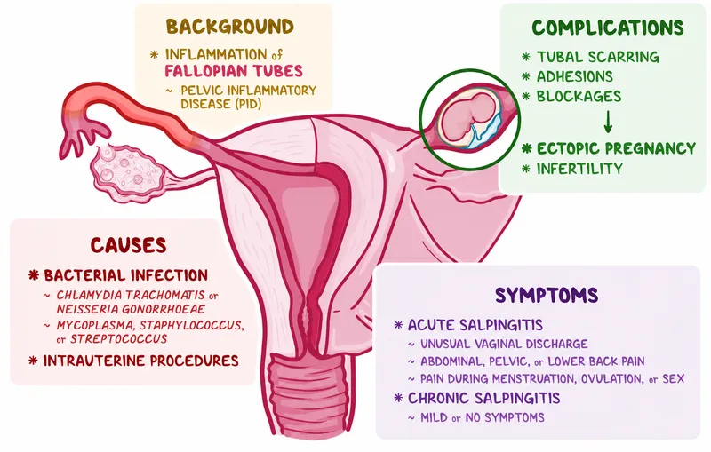 Salpingitis: Causes, Symptoms, and Complications