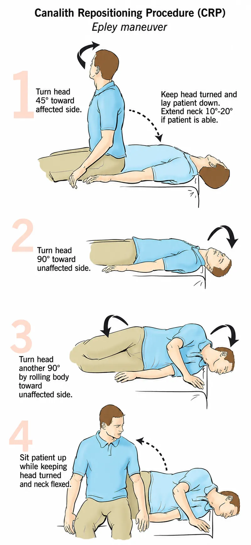 Canalith repositioning procedure for BPPV treatment
