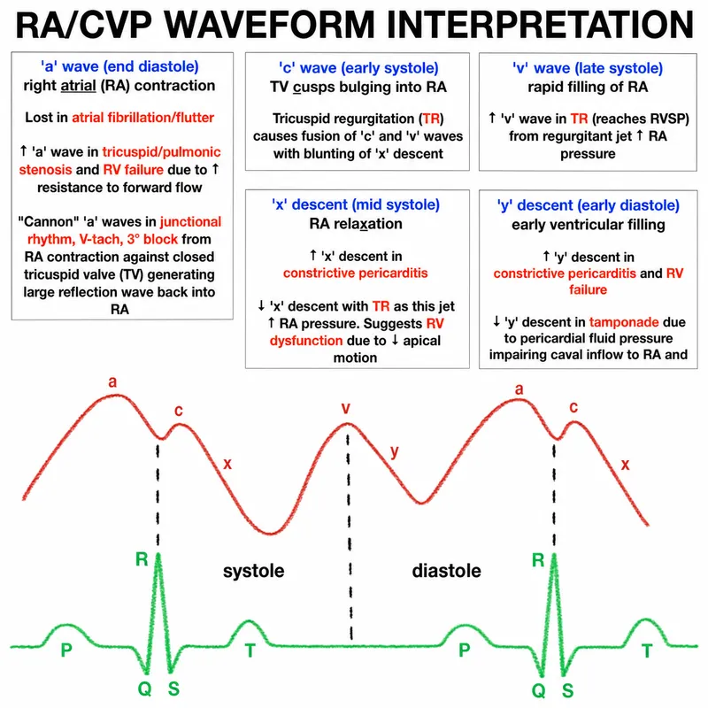 RA/CVP waveform interpretation with ECG correlation