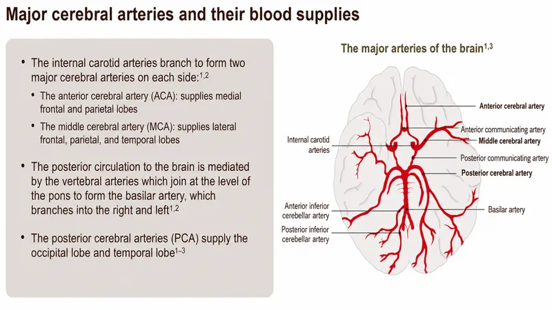 Major cerebral arteries and their blood supplies