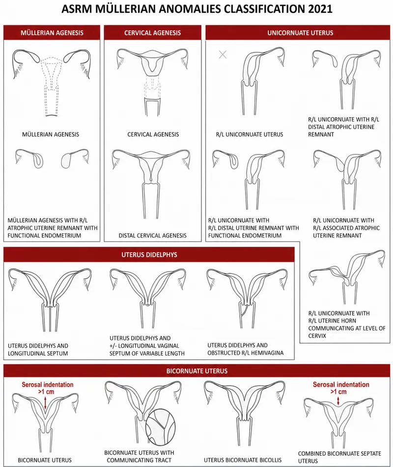ASRM 2021 Mullerian Anomalies Classification (Page 1)