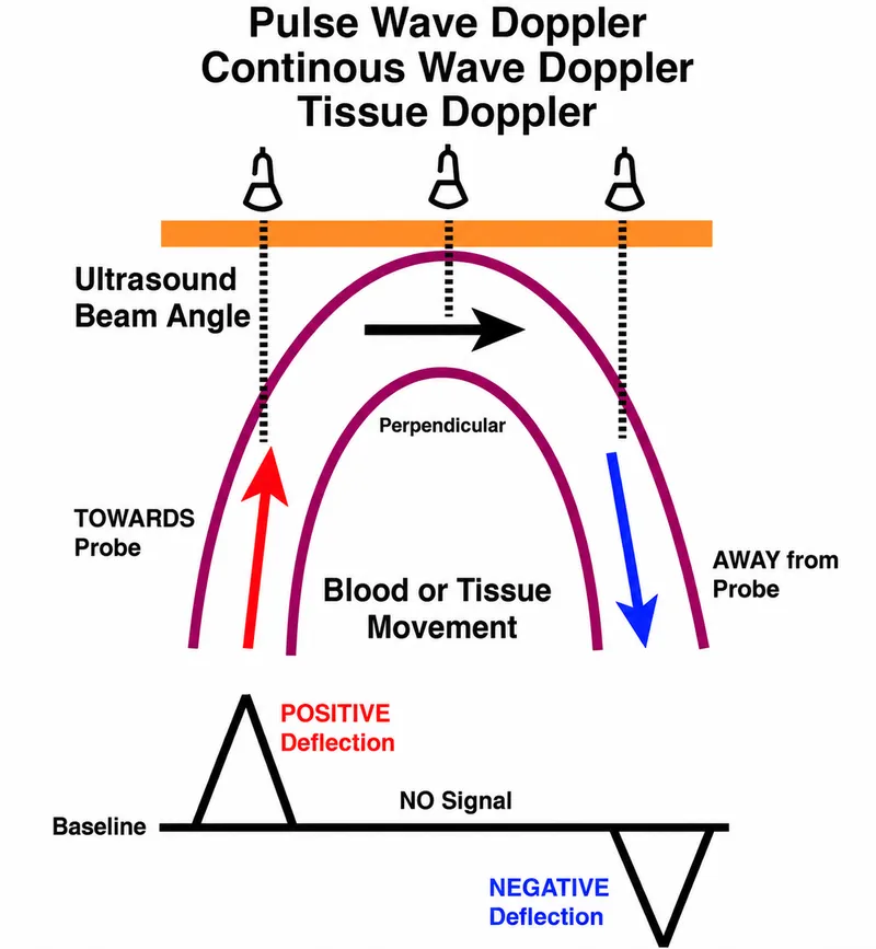 Doppler ultrasound principles: direction of flow
