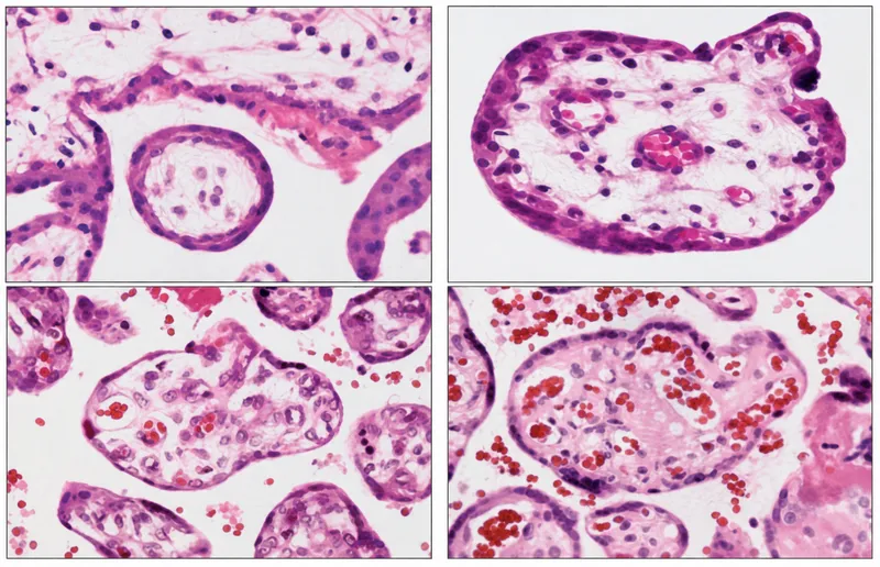 Histology of chorionic villi development stages