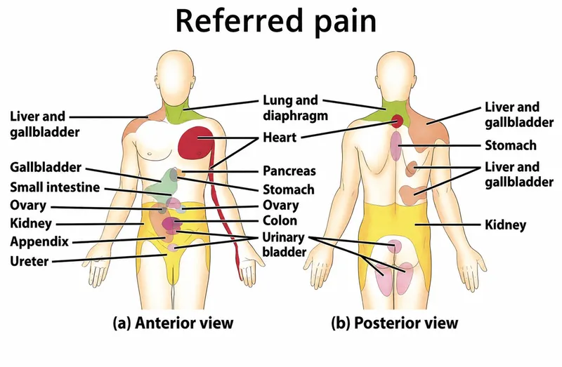Referred pain: Anterior and posterior views