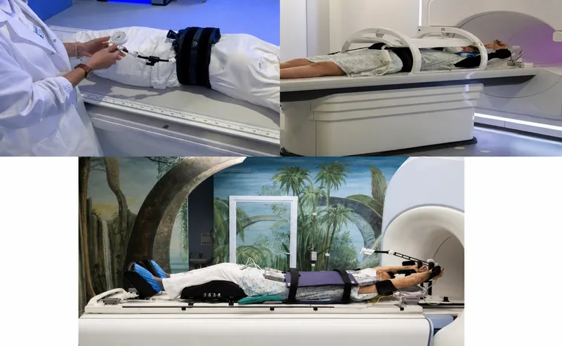 Patient setup for radiation therapy simulation
