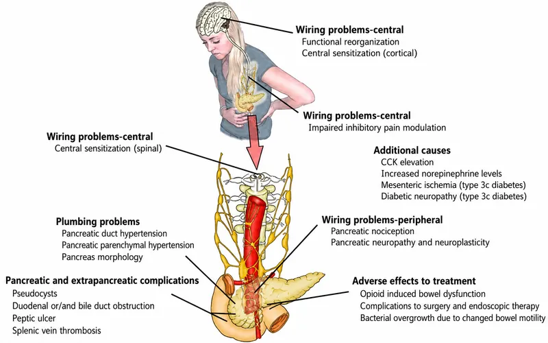 Mechanisms of pain in chronic pancreatitis