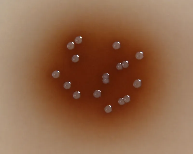 Enterococcus faecalis on Bile Esculin Azide Agar