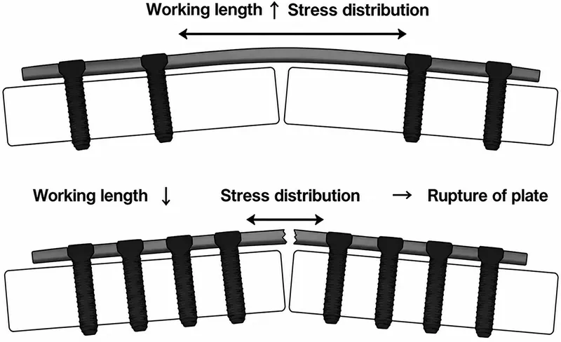 Working length and stress distribution in orthopedic plates