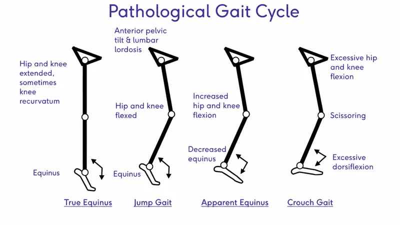 Biomechanical analysis showing compensation patterns in kinetic chain dysfunction