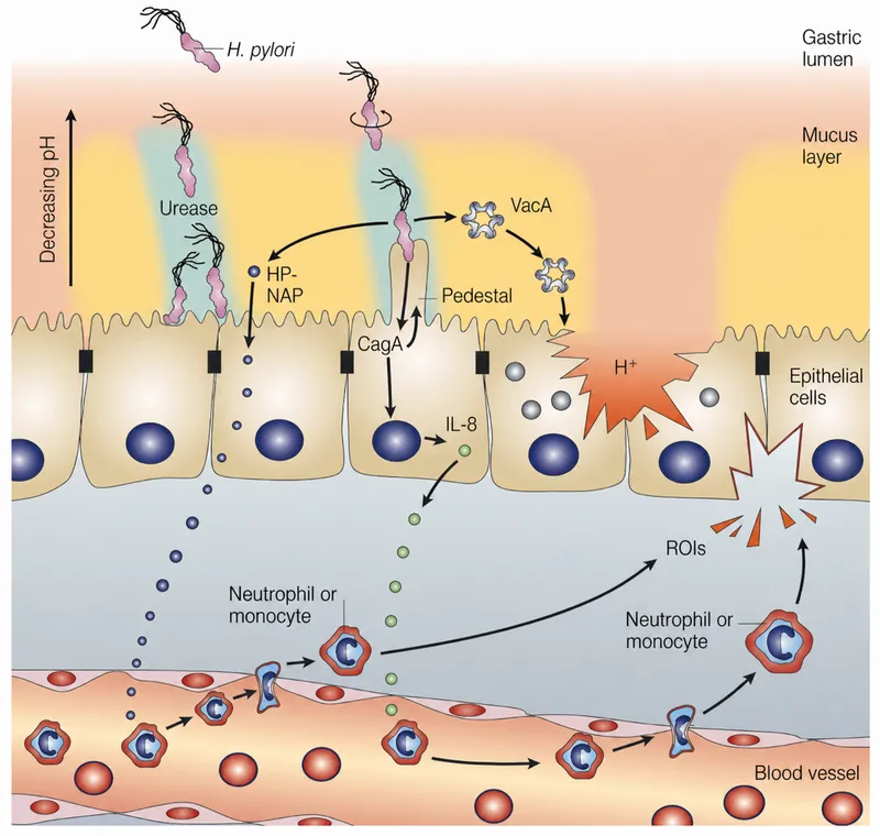 H. pylori pathogenesis and immune response