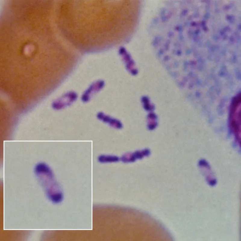 Yersinia pestis bipolar staining
