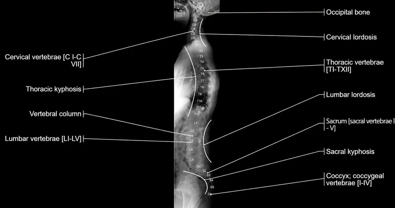 Sagittal X-ray of spine with physiological curvatures