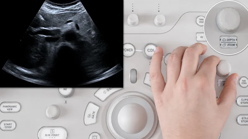 Abdominal Ultrasound Machine and View