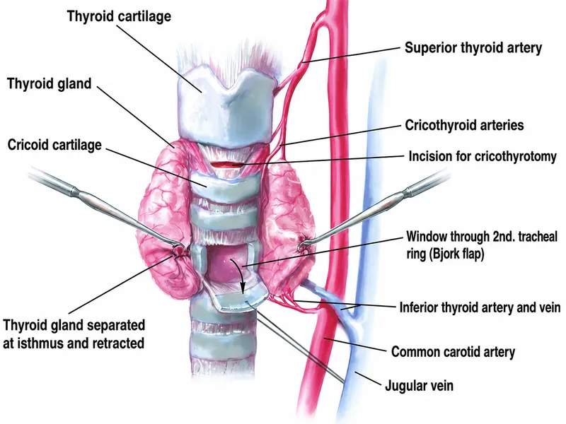 Anatomy for cricothyroidotomy and tracheostomy
