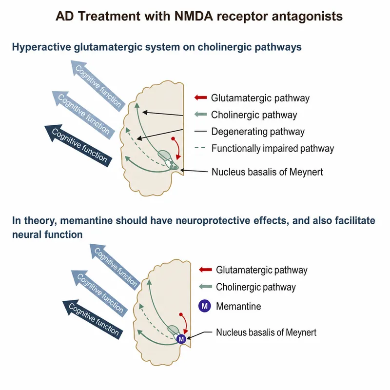 Memantine mechanism in Alzheimer's disease